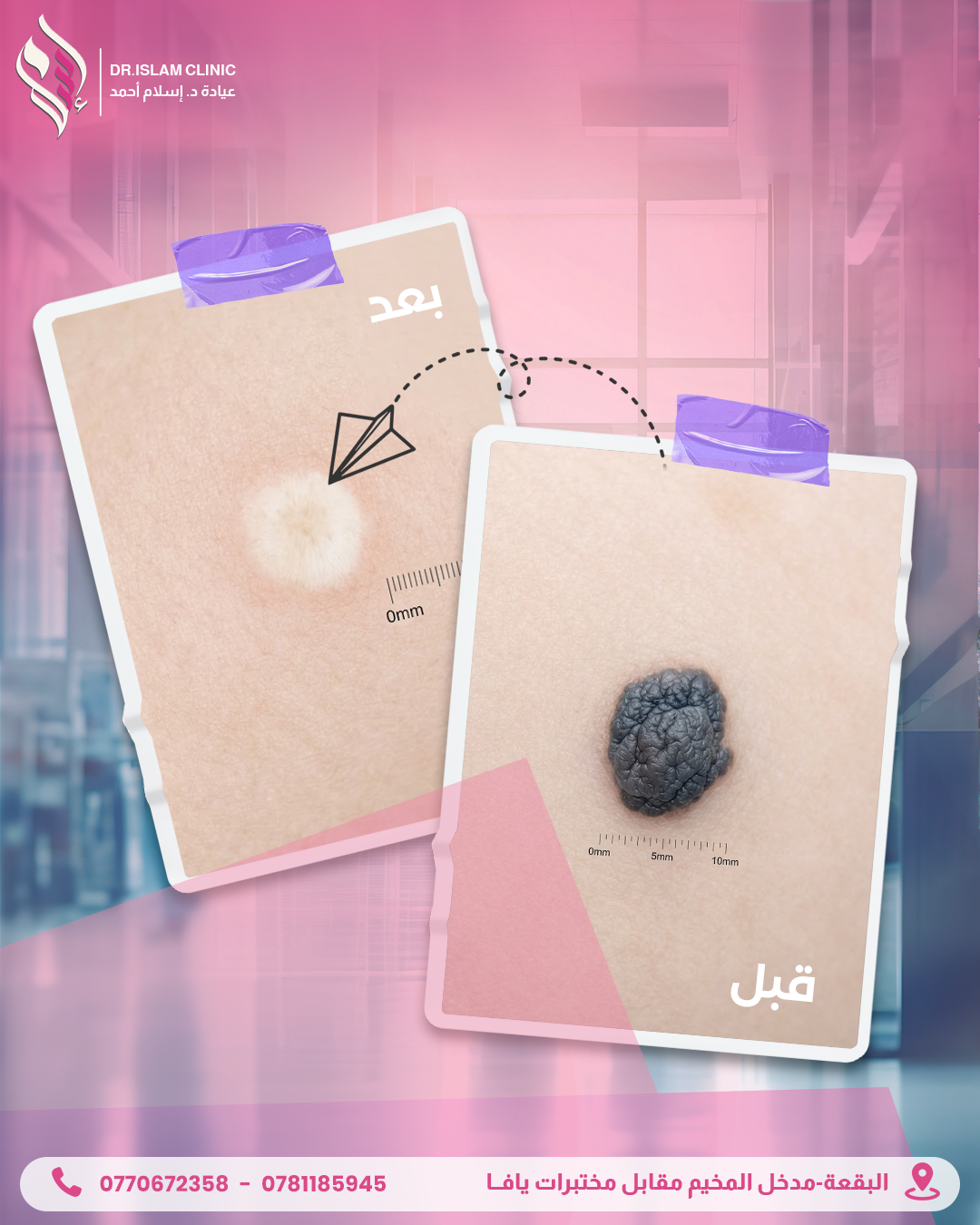 قبل وبعد 1